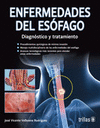 ENFERMEDADES DEL ESOFAGO: DIAGNOSTICO Y TRATAMIENTO