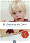 EL SNDROME DE DOWN