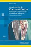 ATLAS DE BOLSILLO DE CORTES ANATOMICOS TOMOGRAFIA COMPUTARIZADA Y RESONANCIA MAGNETICA 2AED T3 (COLU