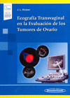 ECOGRAFIA TRANSVAGINAL EN LA EVALUACION DE LOS TUMORES DE OVARIO INCLUYE EBOOK
