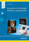 ECOGRAFIA EN PATOLOGIA UTERINA Y ENDOMETRIAL +E