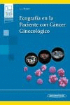 ECOGRAFIA EN LA PACIENTE CON CANCER GINECOLOGICO. +E